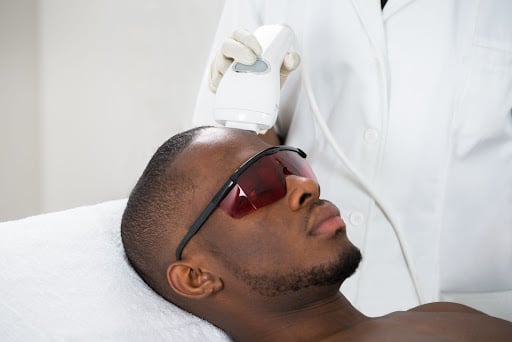 laser hair removal 1